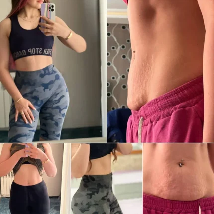 جراحی زیبایی پیکرتراشی